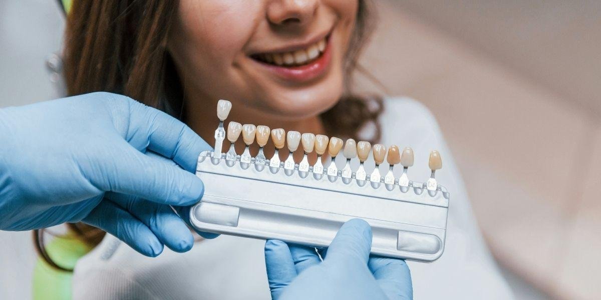 How a Brighter Smile Through Teeth Whitening Can Change More Than Your Reflection